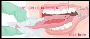 PPT ON LEUKOPLAKIA