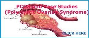 Case Studies on Poly cystic Ovarian Disease (PCOD)