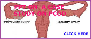 PPT ON A CASE STUDY ON PCOS